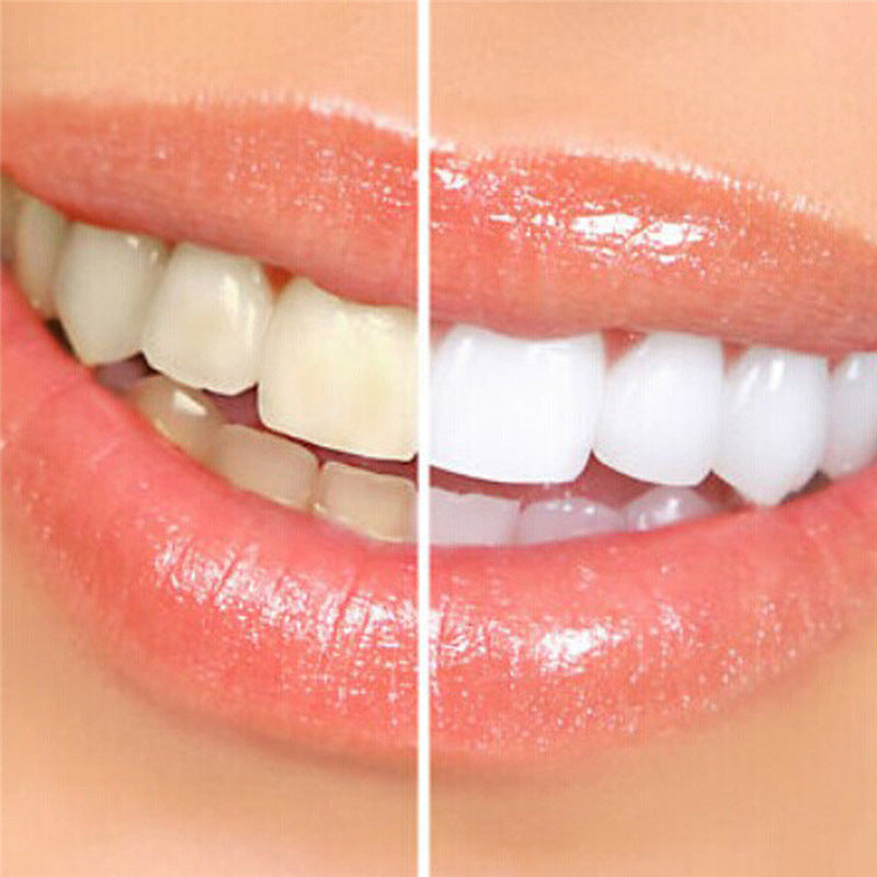 Teeth Whitening Gel Pen