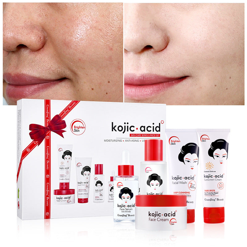 Kojic Acid Toner & Lotion Set for Brighter, Even Skin Tone,Natural Skin Brightening